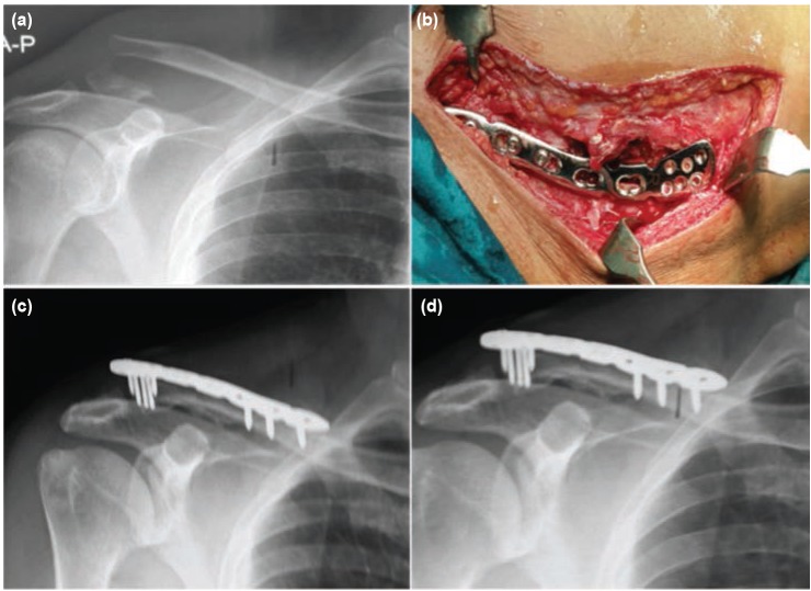 Fig. 3: