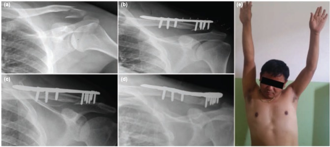 Fig. 2: