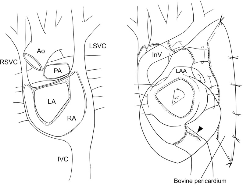 Fig. 2