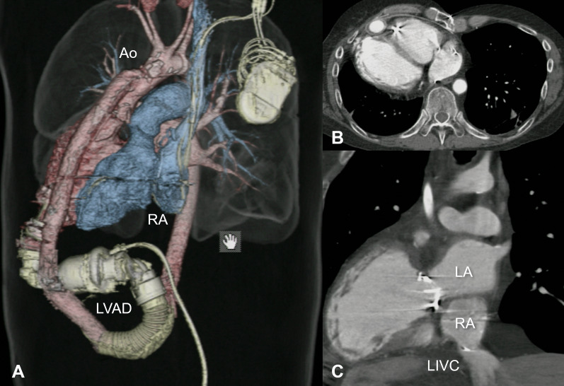 Fig. 1