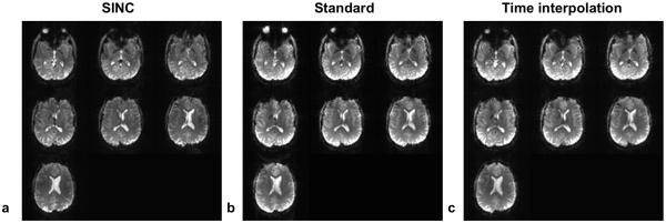 FIG. 10