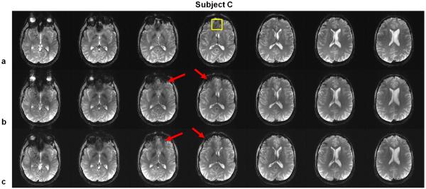 FIG. 9