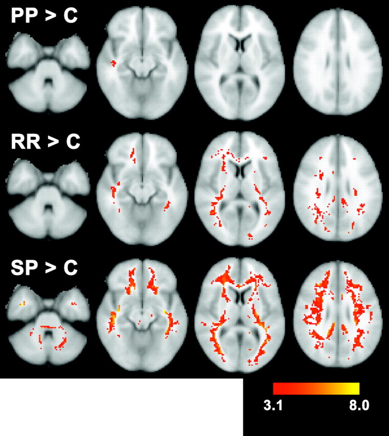 Fig 3.