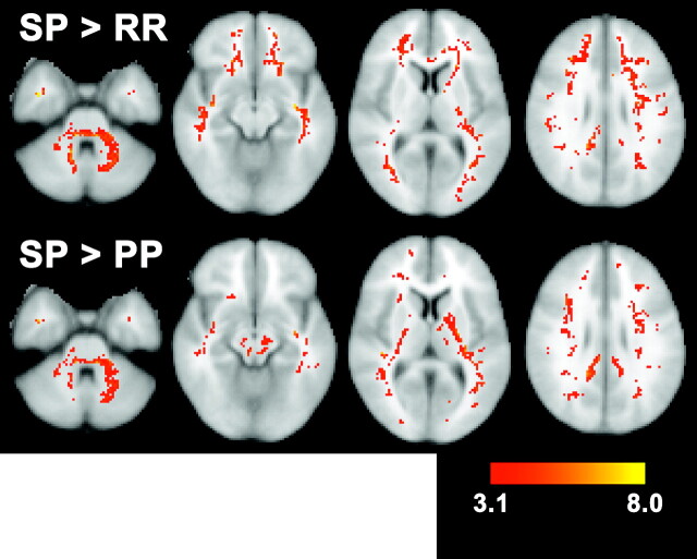 Fig 4.