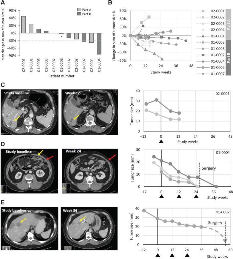 Figure 1. Antitumor activity. A, Maximum changes from baseline in sum of target lesion size. B, Spider plot showing the changes of the target lesion sizes at each radiologic assessment (6-weekly). Each data point was compared with the lesion size measured at baseline. Dotted lines indicate patients receiving a single dose. CT scans and individual target lesion size changes for Patient 02–0004 (C), Patient 01–0004 (D), and Patient 01–0007 (E). Dotted lines denote post-study data for Patient 01–0007. Triangles indicate vaccination dates. Different gray shades on the line graphs and different colored arrows on the scans indicate different target lesions of the patients. *This patient was considered with PD due to clinical progression by the investigator.