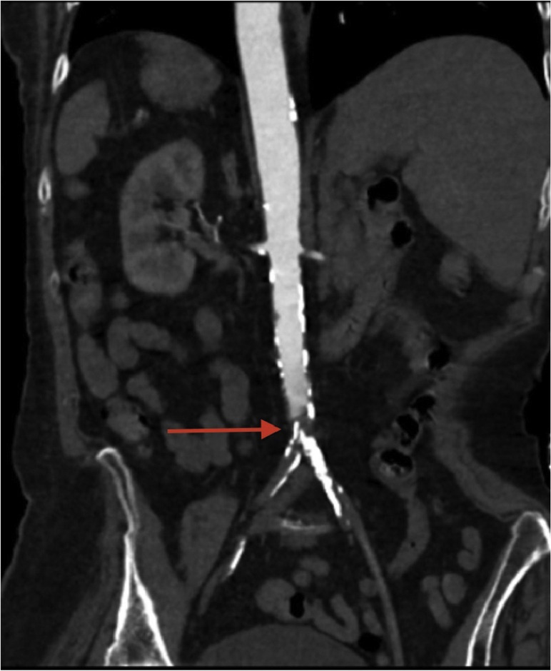 Fig. 1