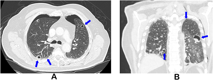 Fig. 2