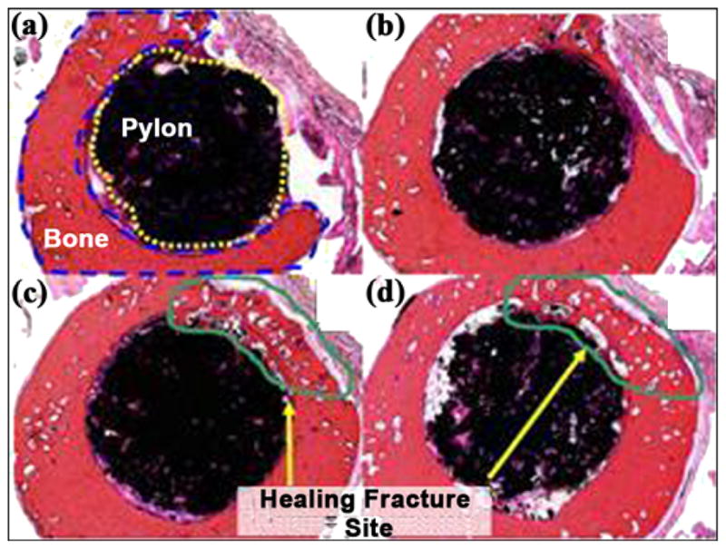 Figure 21