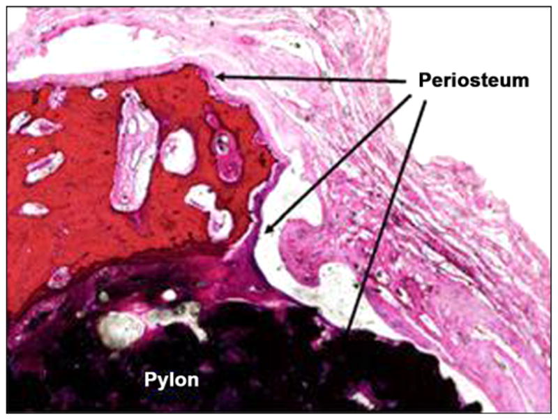 Figure 23