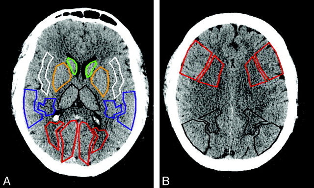 Fig 1.