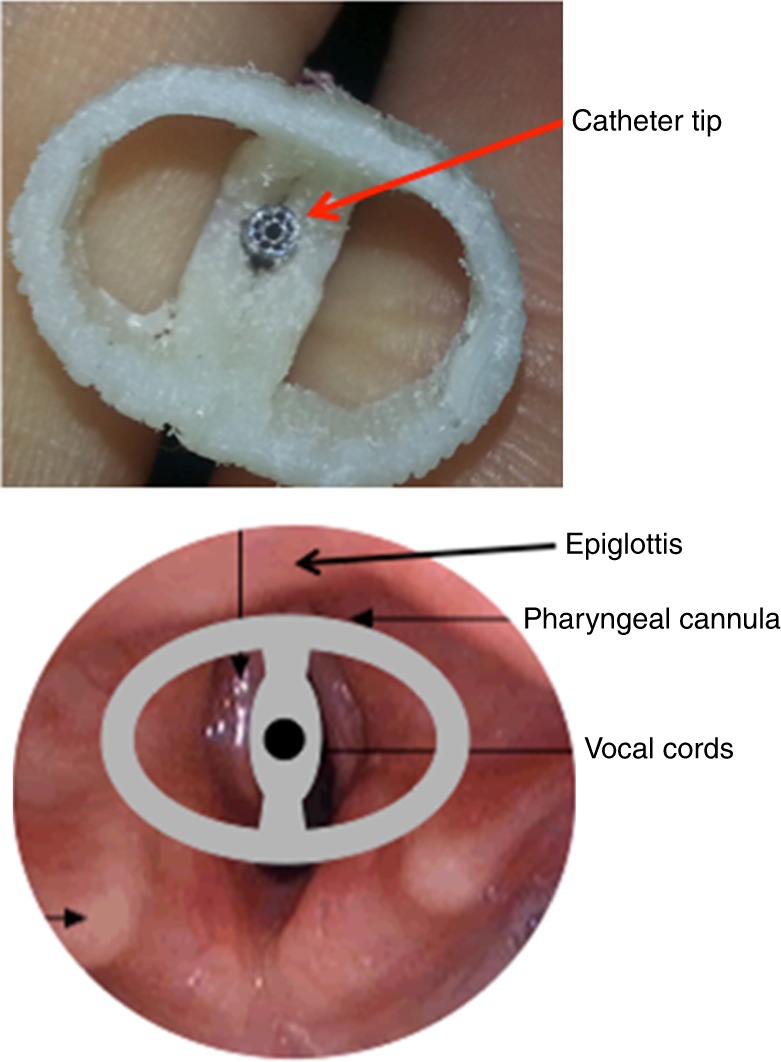 Fig. 2