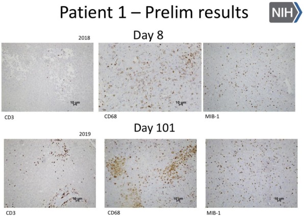 Fig. 3 (abstract P371).