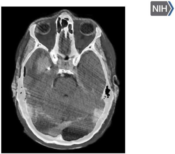 Fig. 2 (abstract P371).