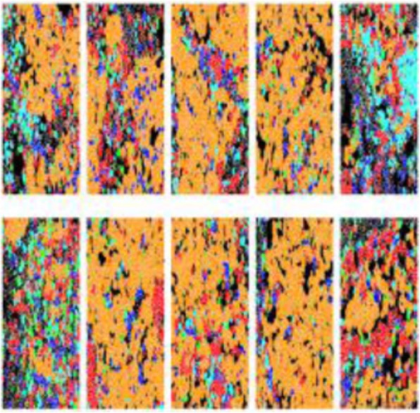 Fig. 1 (abstract P51).