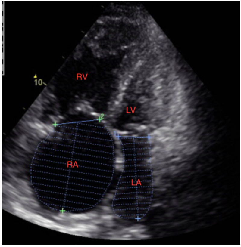 Figure2: