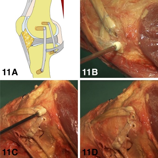 Figure 11