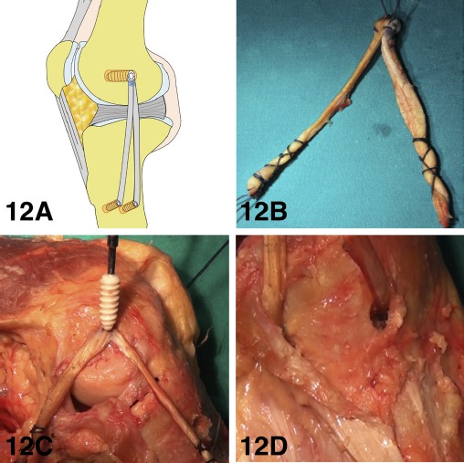 Figure 12