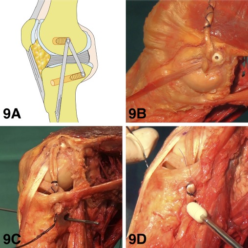 Figure 9