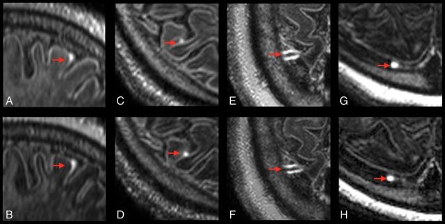 Fig 3.