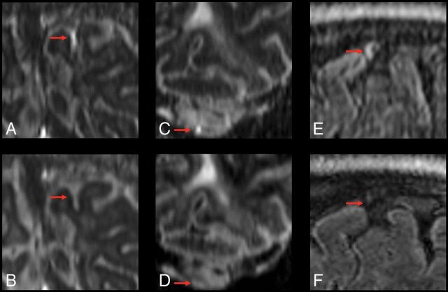 Fig 4.