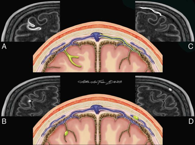 Fig 1.