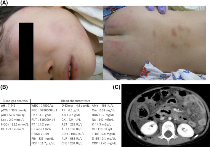 Fig. 1