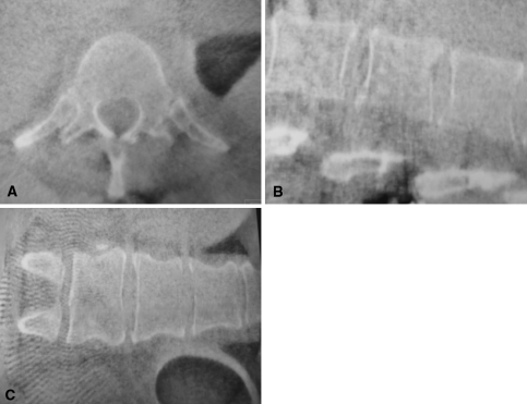 Fig. 1A–C