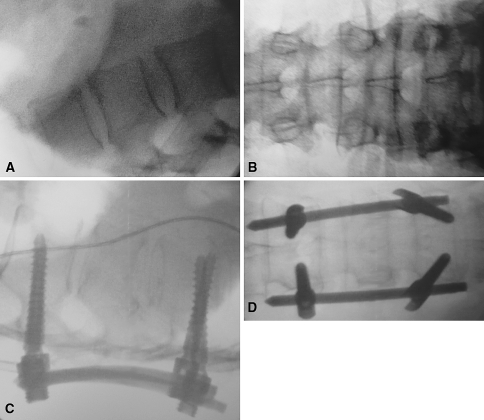 Fig. 2A–D