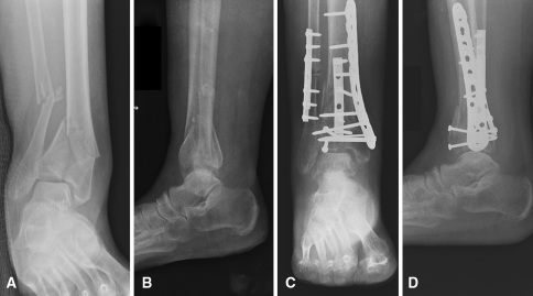 Fig. 1A–D