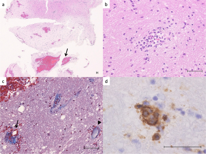 Fig. 2