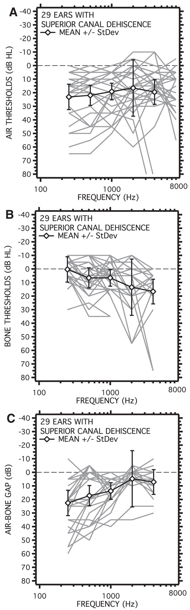 Fig. 12