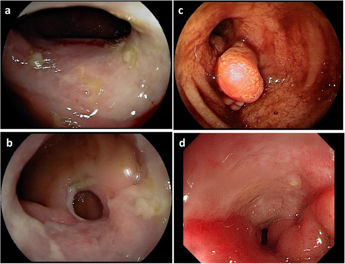 Fig. 2