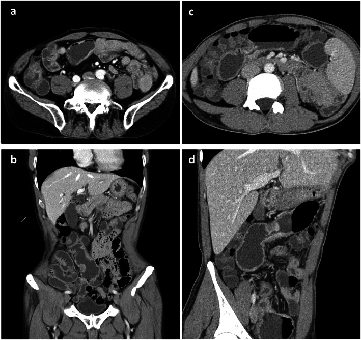 Fig. 1