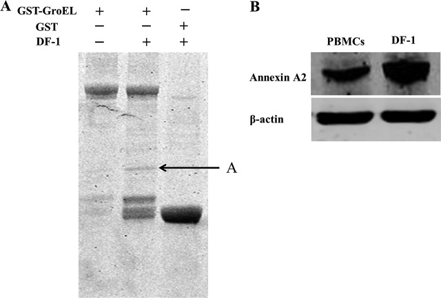 FIG 3