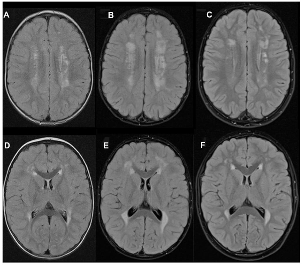 FIG 2.