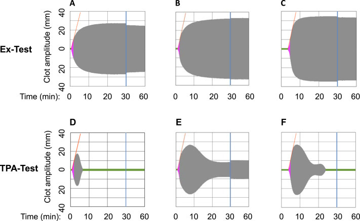 Fig. 1