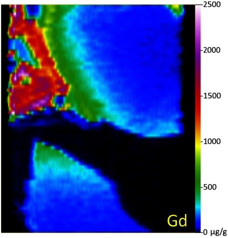 Fig. 9. The False color image of Gd concentration map created by “100% normalization method.” Signal intensity image of this area is shown in Fig. 4(a).