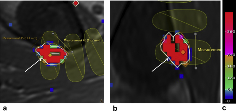 Figure 1