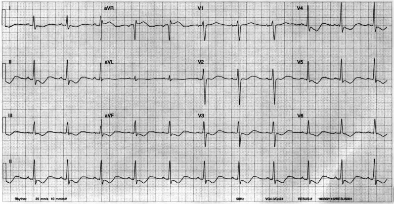 Figure 1: