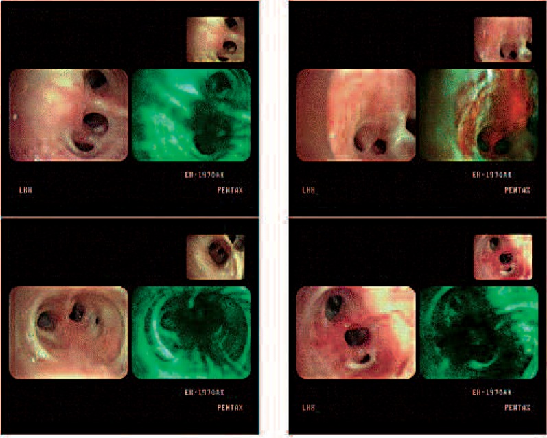 Figure 3-3: