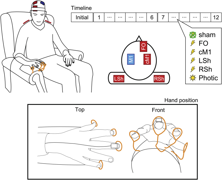 Figure 1