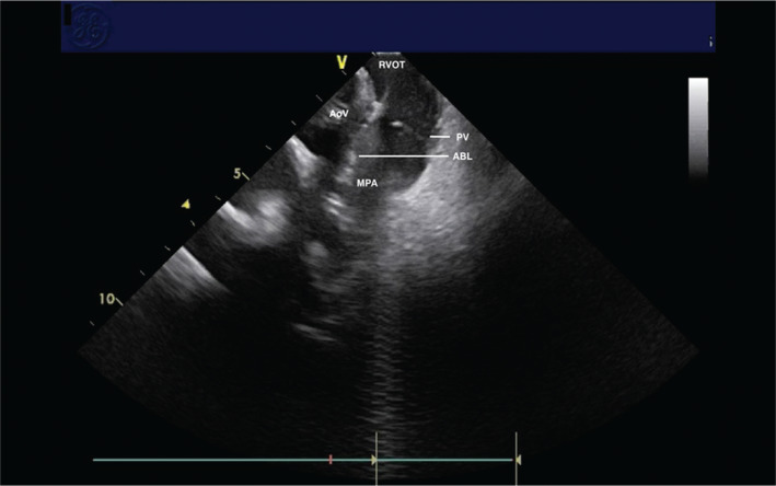 Figure 3: