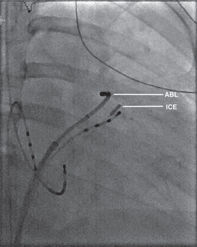 Figure 2: