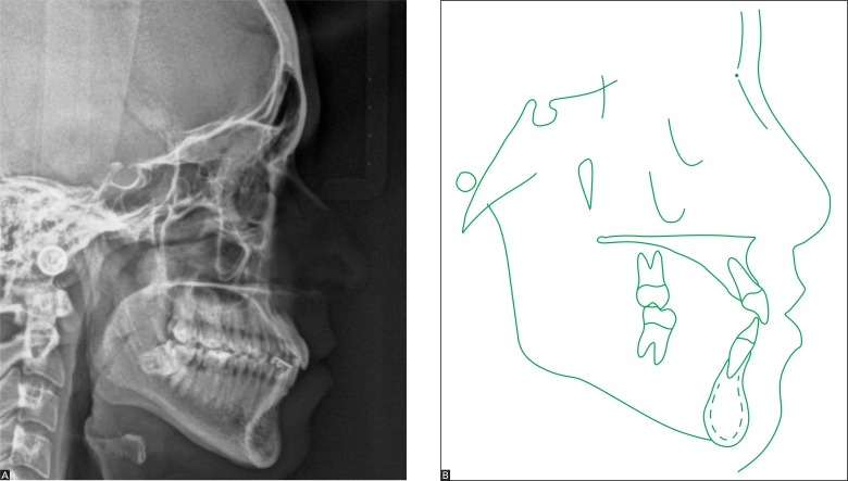 Figure 15