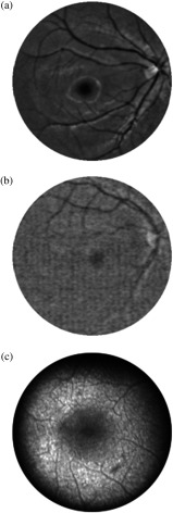 Fig. 13