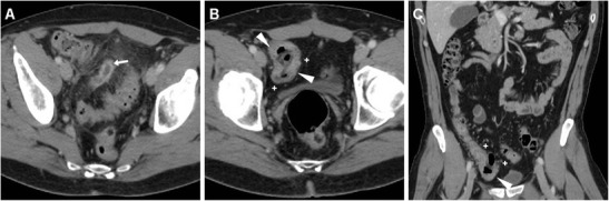 Fig. 2