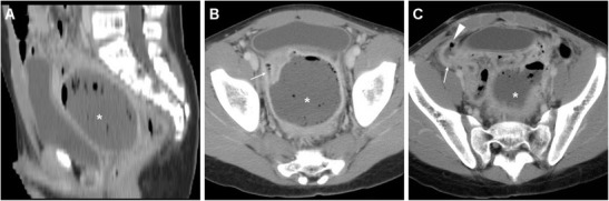 Fig. 7