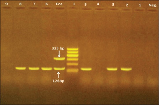 Figure-1