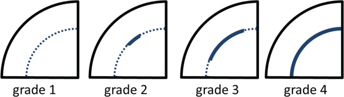 Fig 2.