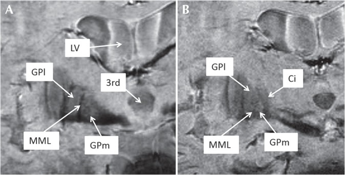 Fig 4.